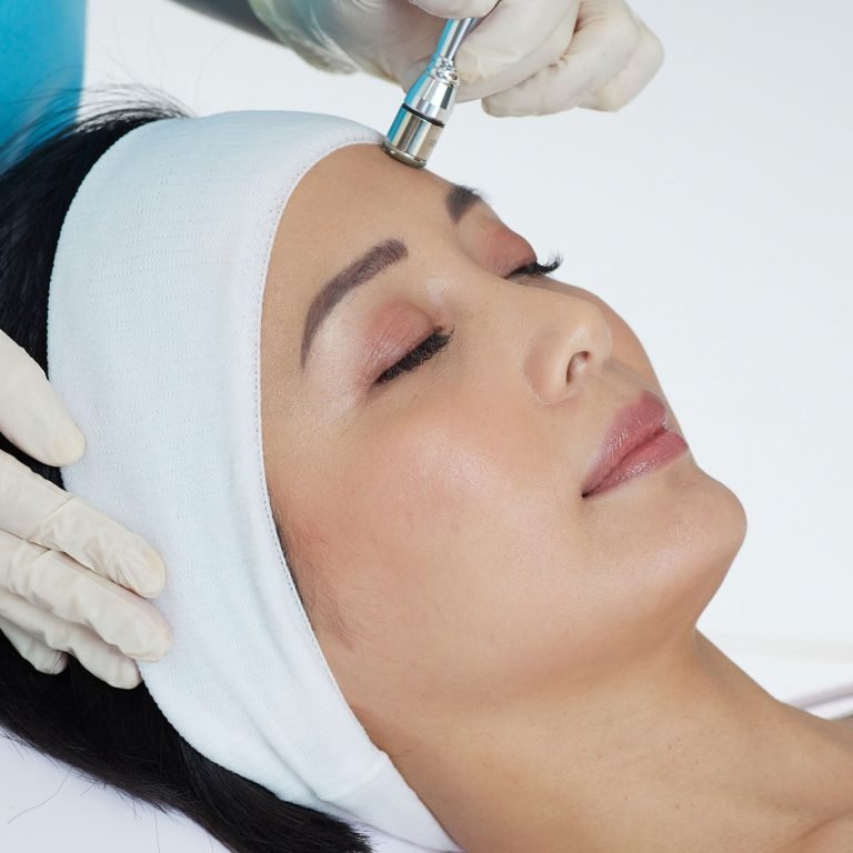 Microdermabrasion
