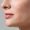 acne-treatment-1