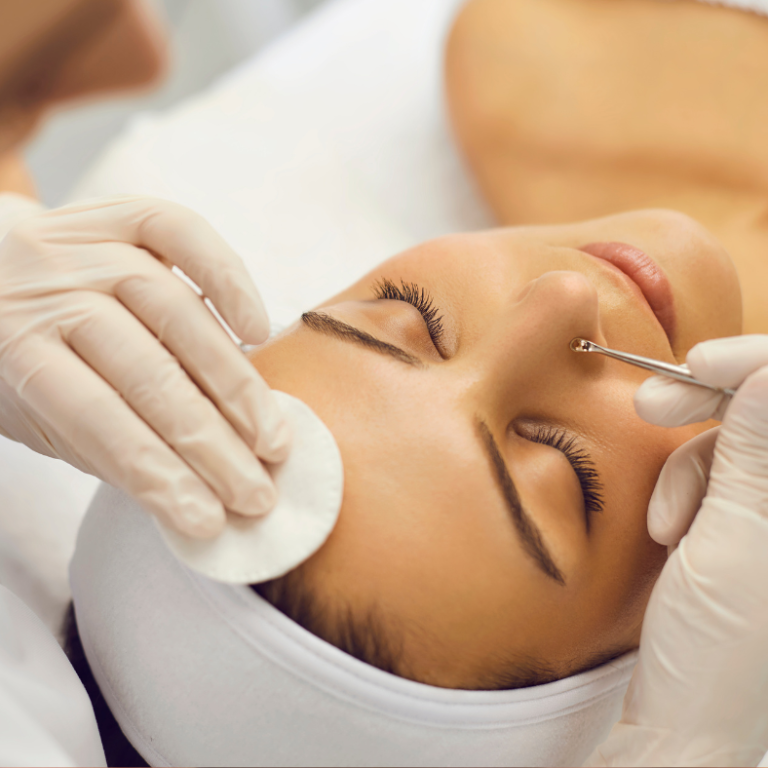 blackhead-removal-main